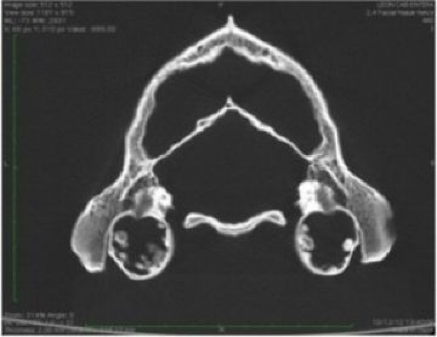 Diagnostican problemas de oído en leones cautivos